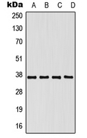 CPA1858-100ul - PCBP1