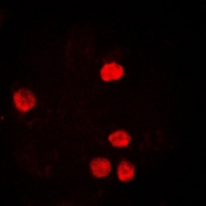CPA1860-100ul - PCNA