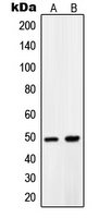 CPA1868-100ul - PDK1