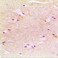 CPA1874-100ul - Peroxin 14 / PEX14