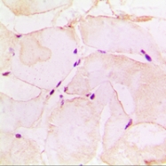 CPA1880-100ul - Pepsin A