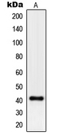 CPA1880-100ul - Pepsin A