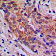 CPA1890-100ul - PI3K p85 alpha/p55 gamma