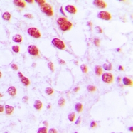 CPA1907-100ul - DNA polymerase beta