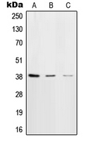 CPA1907-100ul - DNA polymerase beta