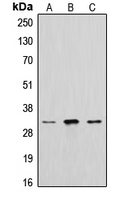 CPA1918-100ul - Cathepsin A