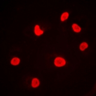 CPA1942-100ul - DNA-PKcs / PRKDC / XRCC7