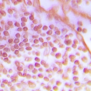 CPA1942-100ul - DNA-PKcs / PRKDC / XRCC7