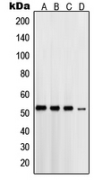 CPA1958-100ul - Presenilin-1