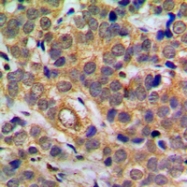 CPA1997-100ul - RELA / NF-kB p65