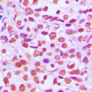 CPA2000-100ul - RELA / NF-kB p65