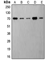CPA2031-100ul - RPS6KB1 / STK14A