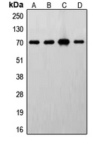 CPA2032-100ul - RPS6KB1 / STK14A