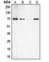 CPA2033-100ul - RPS6KB1 / STK14A