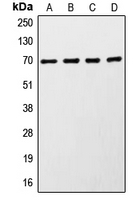 CPA2034-100ul - RPS6KB1 / STK14A