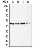 CPA2035-100ul - RPS6KB1 / STK14A