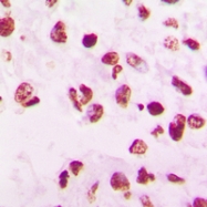 CPA2086-100ul - SNAI1