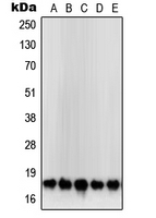 CPA2092-100ul - Superoxide Dismutase 1 / SOD1