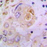 CPA2096-100ul - Osteopontin / SPP1