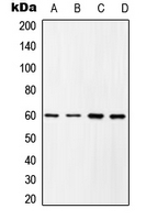 CPA2098-100ul - SRC1
