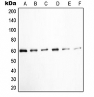CPA2099-100ul - SRC1