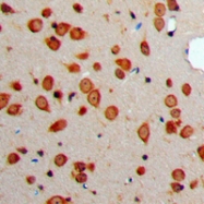 CPA2106-100ul - Somatostatin / SST