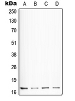 CPA2106-100ul - Somatostatin / SST