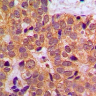 CPA2110-100ul - STAT1