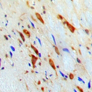 CPA2111-100ul - STAT1