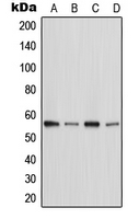 CPA2120-100ul - STK3