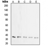 CPA2132-100ul - Synaptophysin / SYP