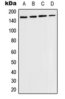 CPA2143-100ul - CD202b / TEK