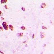 CPA2146-100ul - TFAP2A / AP2 alpha/beta