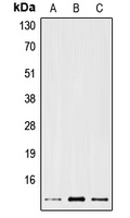 CPA2150-100ul - Trefoil factor 1 / pS2