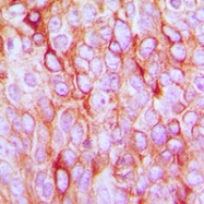 CPA2153-100ul - TGF-alpha (TGFA)