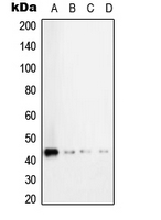 CPA2154-100ul - TGFB1