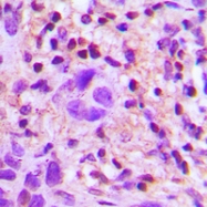 CPA2155-100ul - TGF-beta-2 (TGFB2)