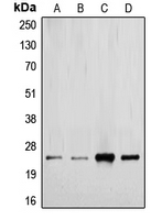CPA2155-100ul - TGF-beta-2 (TGFB2)