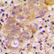 CPA2156-100ul - TGF-beta-3 (TGFB3)