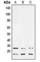 CPA2156-100ul - TGF-beta-3 (TGFB3)