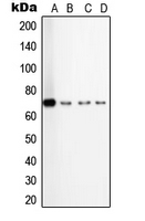 CPA2158-100ul - TGFBR2
