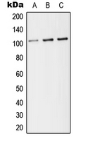 CPA2160-100ul - CD141 / THBD