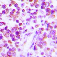 CPA2174-100ul - Tumor necrosis factor (TNF-alpha)