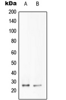 CPA2174-100ul - Tumor necrosis factor (TNF-alpha)