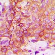 CPA2177-100ul - CD120a / TNFR1