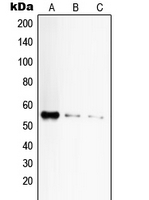 CPA2177-100ul - CD120a / TNFR1