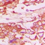 CPA2178-100ul - CD120b / TNFR2