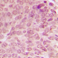CPA2184-100ul - TP53 / p53