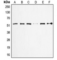 CPA2186-100ul - TP53 / p53