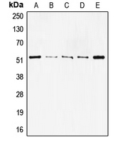 CPA2187-100ul - TP53 / p53